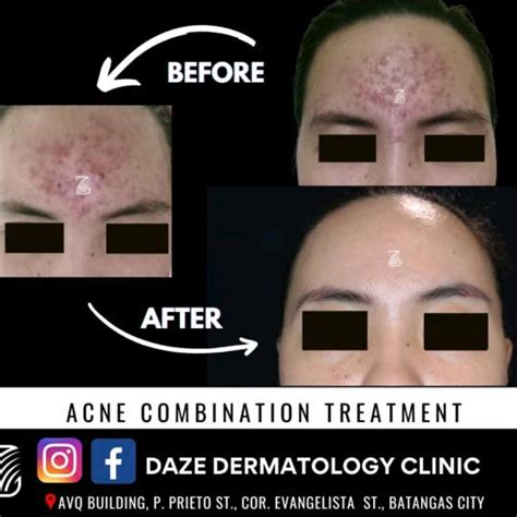 dazedermatologyclinic (@dazedermatologyclinic) .